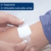 3M Micropore 3M Micropore MM1530-2 3M MICROPORE SURGICAL TAPE 5CM