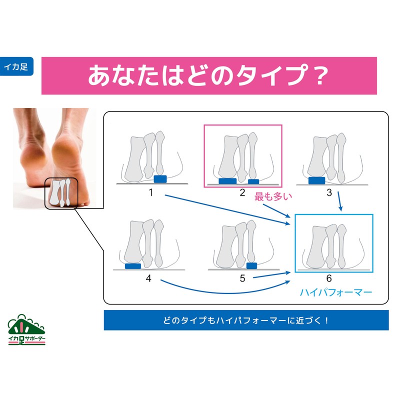 Squid Foot Supporter Relevé Basic with Refill Socks, Medium Size