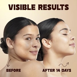 ISTON Ultra-Moisturizing Vitamin C Facial Serum 50ml – With Hyaluronic Acid, Niacinamide & Peptides, Anti-Aging, Brightens Dark Spots, Evens Skin Tone & Reduces Fine Lines