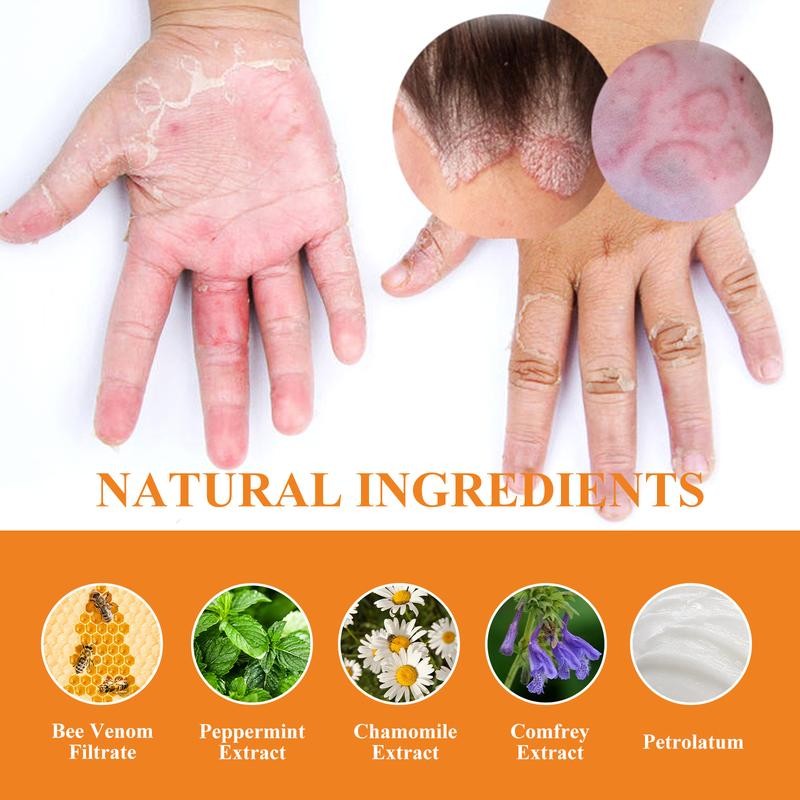 Wellness South Moon Anti-Itch Bee Venom Psoriasis Cream Cooling Soothing