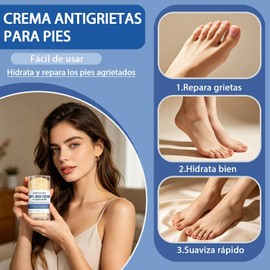 3PCS Crema para Pies,Crema Hidratante con Urea 60 para Pies,Exfoliante para Pies para Pies Resecos y Agrietados,Reparar e hidratar la piel seca y agrietada,Exfoliante para Callos y Piel Gruesa(2 PCS)