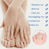 8 Pcs Non-Slip Hammer Toe Straightener Corrector for Comfortable Alignment