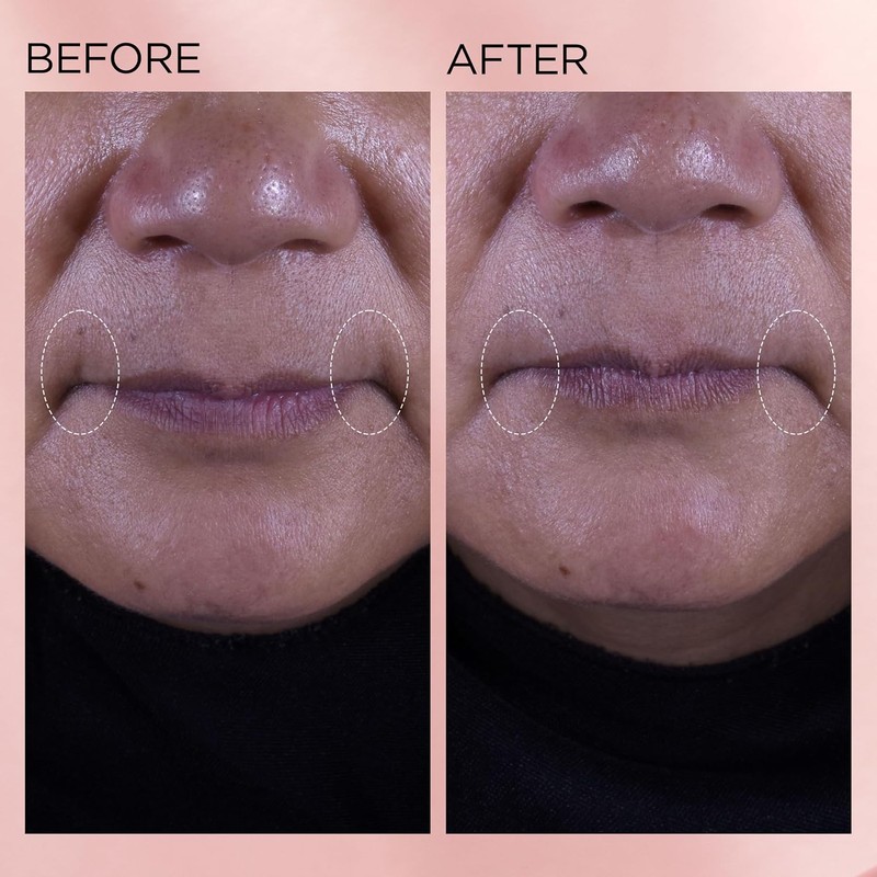 Elizabeth Arden Retinol + HPR Crema Renovadora de Rostro con