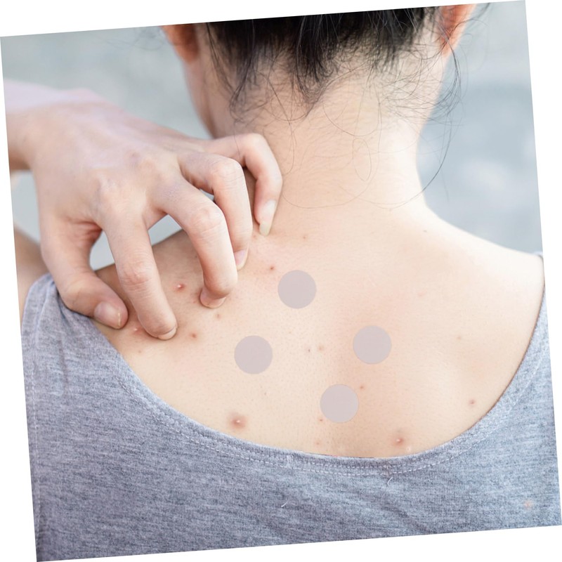 Ipetboom Multi-functional Patch 2pcs Waterproof Pimple Sticker for Skin Care