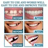 Snap on Veneers Dentures Fake Teeth,Snap on Veneers Teeth,Temporary Ve/neers