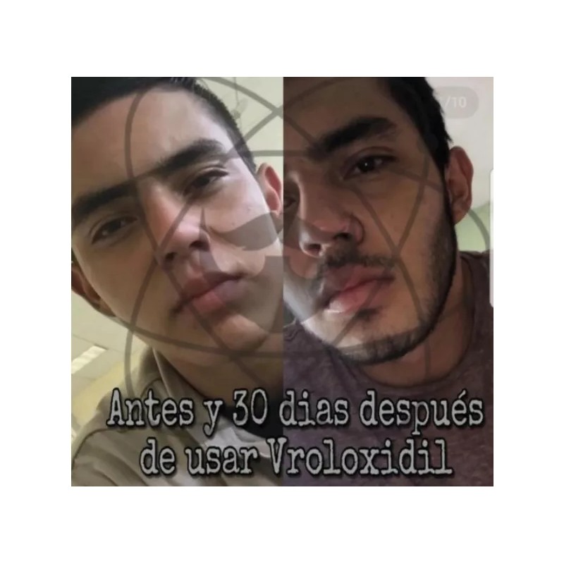 BARB LAB Combo 2 Aceites Para El Crecimiento De Barba