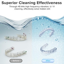 Ultrasonic Retainer Cleaner, 180ML/45kHz Portable Ultrasonic Jewelry Cleaner, Quiet Operation Ultrasonic Cleaner Machine for All Dental Appliances,Dentures,Aligners,Mouth Guards,Night Guards
