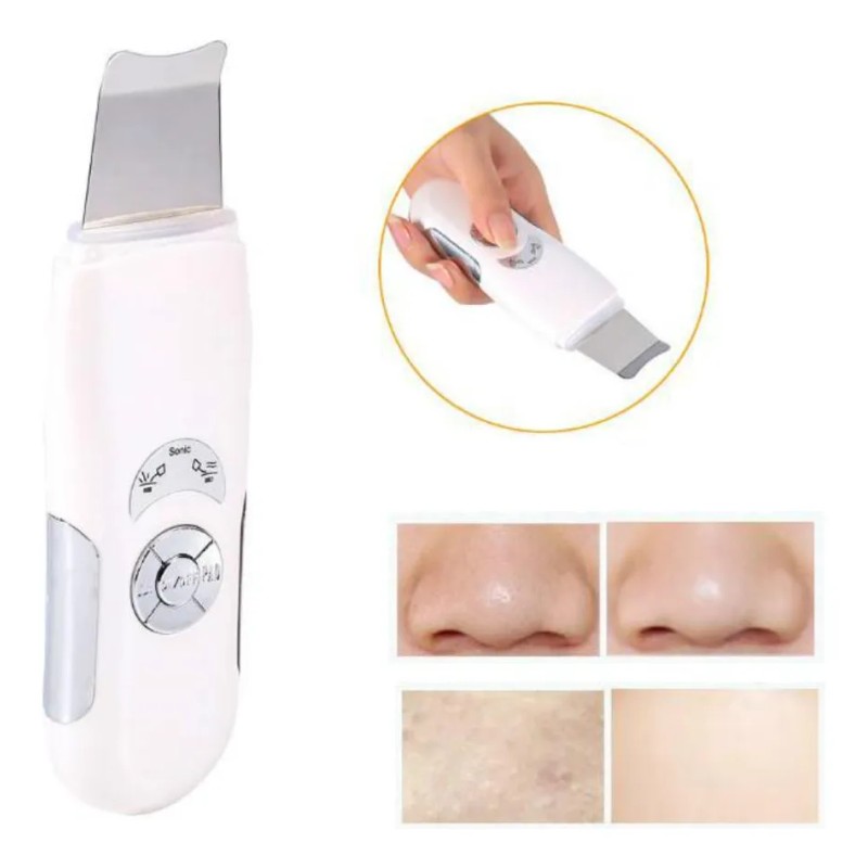 Portable Ultrasónica Eliminación De Extractor De Acné -
