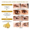 Parches Ojos Colágeno Ojeras