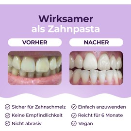 OnlySmile Teeth Whitening Powder – 2024 Test Winner – Advanced Tooth Powder for a Brighter, Whiter Smile – Professional-Grade Teeth Whitening Solution for Removing Stains & Discoloration – Gentle & Effective Teeth Bleaching for Home Use