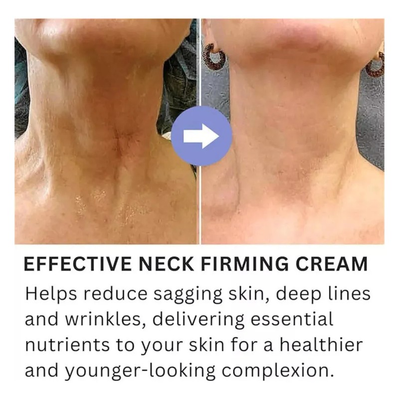 . 2x Neck Cream Tighten & Lift Firming, Neck Firming