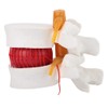1:1.5 Human Herniated Disc Model Spine Anatomical Medical Study Demonstration