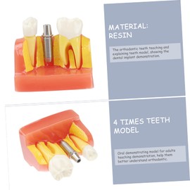 ULTECHNOVO Realistic 4 Times Model Teeth Teaching Model Analysis for Oral Communication and Practice