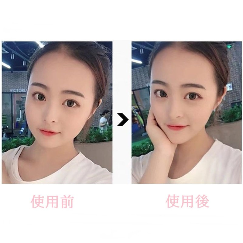 88flix 韓国 小顔テープ リフトアップテープ たるみ しわ 矯正 しわ伸ばし 小顔ベルト フェイスライン