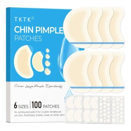 Parches Para Espinillas (100 Unidades, 6 Tamaños), Parche Hi