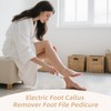 Electric Foot Callus Remover, Electronic Foot File, Portable Callus Remover