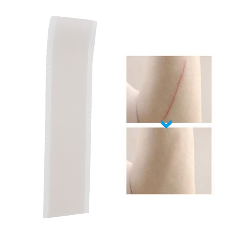 0.4mm Ultra Thin Scar Patch Silicone Gel Wound Marks Removal