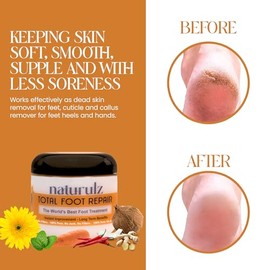 Naturulz Total Foot Repair 4oz – Crema de pies de humedad intensiva para pieles extremadamente secas y ásperas y talones y pies agrietados, reparación
