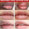 Sale!! Remove Dark Lip Balm Lighten Melanin Keeping Elasticlip Mask