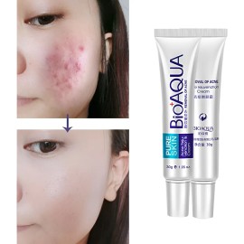 Crema Anti Acné Barros Granos Hidrata Puntos Negros Aclara