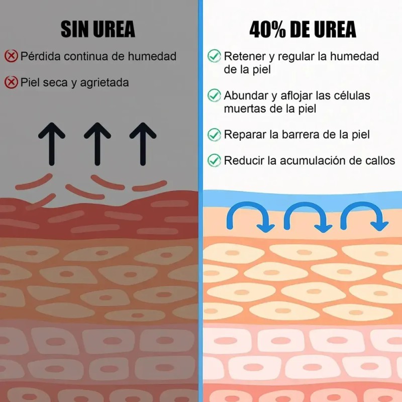 Crema Para Pies Con 42% De Urea Más 2% De