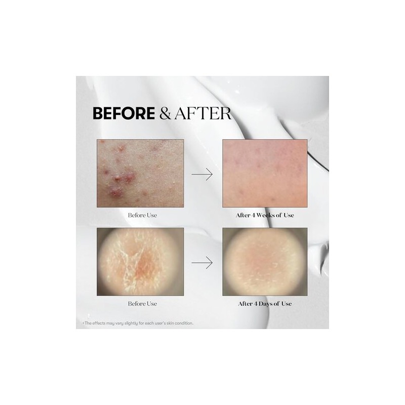 VT Cosmetics [VT Cosmetics]Reedle Shot 50