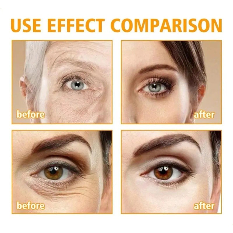 Crema Reafirmante Para Ojos, Elimina Bolsas Y Ojeras