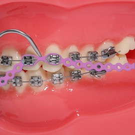 faruijie Colourful Elastic Power Chain for Braces Dental Orthodontic Powerchains 3 Sizes Ortho Rubber Band(Continuous,Purple 28#)