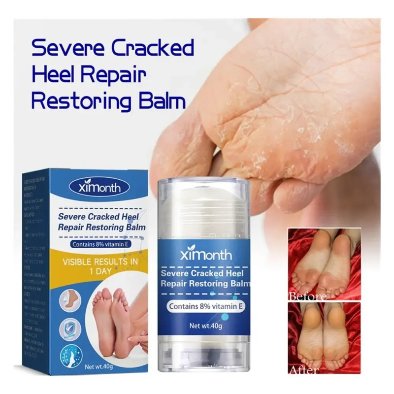 Be - 2×crema Reparadora Grietas Secas Y Talones For Pies