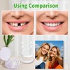 2 Pairs, Adjustable for Men and Women, Regain Confidence Smile,