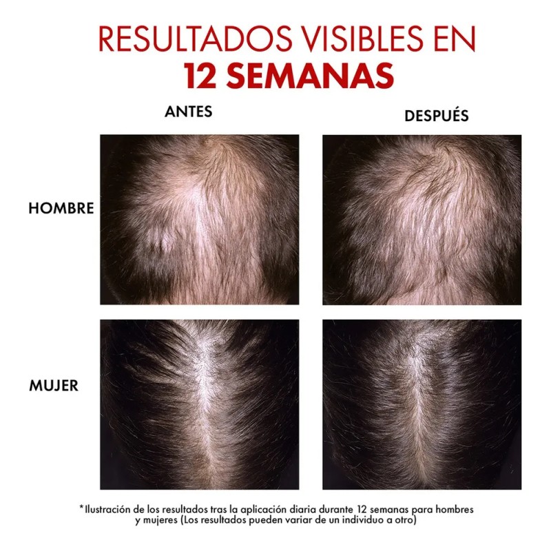 Vichy Dercos Regen Serum 90ml Para Cuidado Capilar