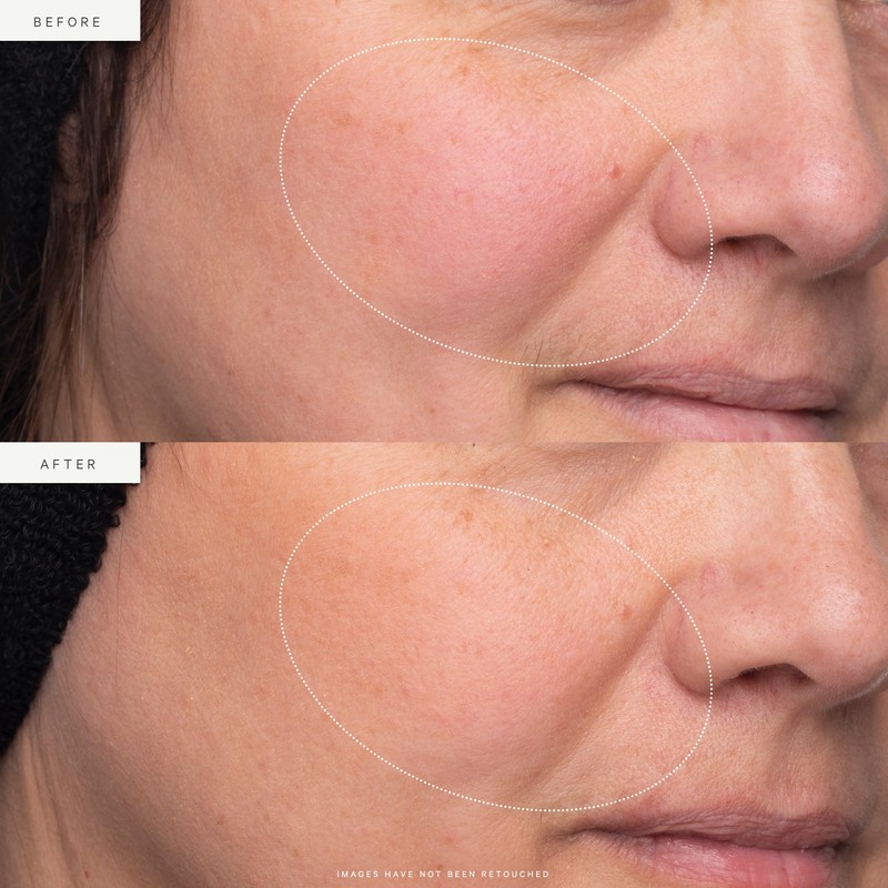 KORA Organics Turmeric Glow Moisturizer 15ml