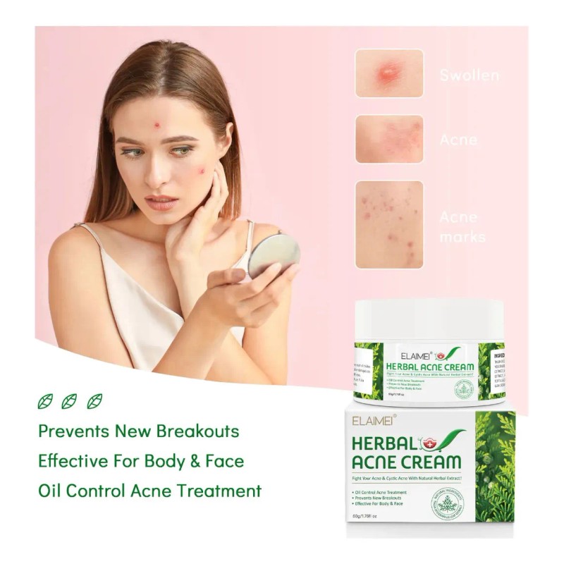 Crema Herbal Antiacné Control Grasa, Granos Espinillas 2 Pzs Acneica