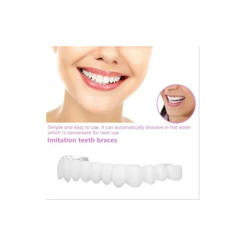Carillas Estéticas Snap On Smile Veneers Dientes Temporales