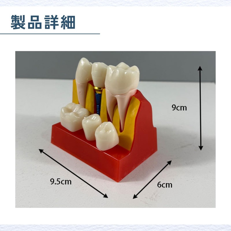 ideamall Implant Model Teeth Course Practice Model Educational Compact