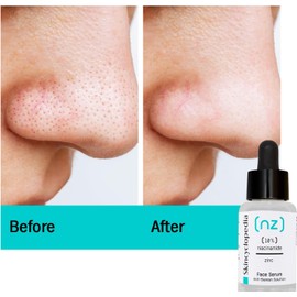 Skincyclopedia Suero Facial De Niacinamida Pura Y Zinc, Solución Antiimperfecciones Y Minimizador De Poros, Control Del Acné Y Equilibrante De La Grasa, Elimina Las Marcas Y Las Imperfecciones Del