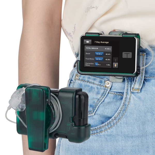 iGuerburn tSlim X2 Pump Case with Rotating Clip, Tandem Pump