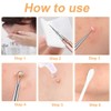 IKOPFLN 1 piece blackhead remover, pimple removal tool, comedone squeezer,