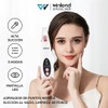 Winland Aspirador de puntos negros eléctrico, herramienta limpiadora de puntos