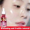 Suero Facial Cqk Aclarante Y Despigmentante 20+