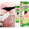 Crema Natural A Base De Hierbas Antipicazón, Crema Para Psoriasis