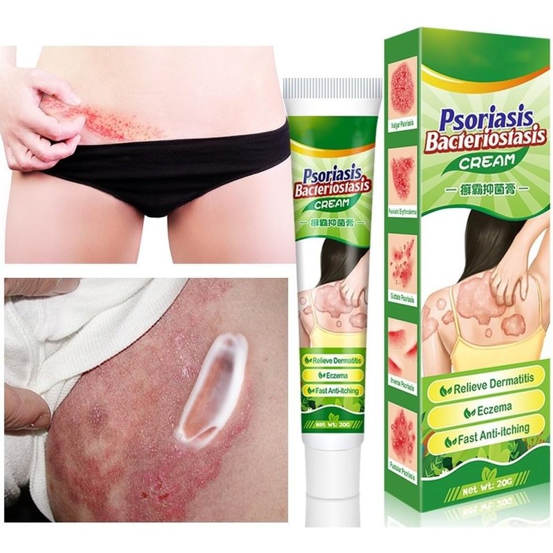 Crema Natural A Base De Hierbas Antipicazón, Crema Para Psoriasis
