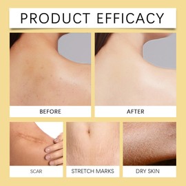 Rostblant Vitamin E Öl,Mit einer Essenzspenderflasche, Vitamin E Öl Bio für Kosmetik, Straffung Prallen Haut, Reines Vitamin E Öl für Haut, Narben, Gesicht & Body, Vitamin E Tropfen Cremes (45)