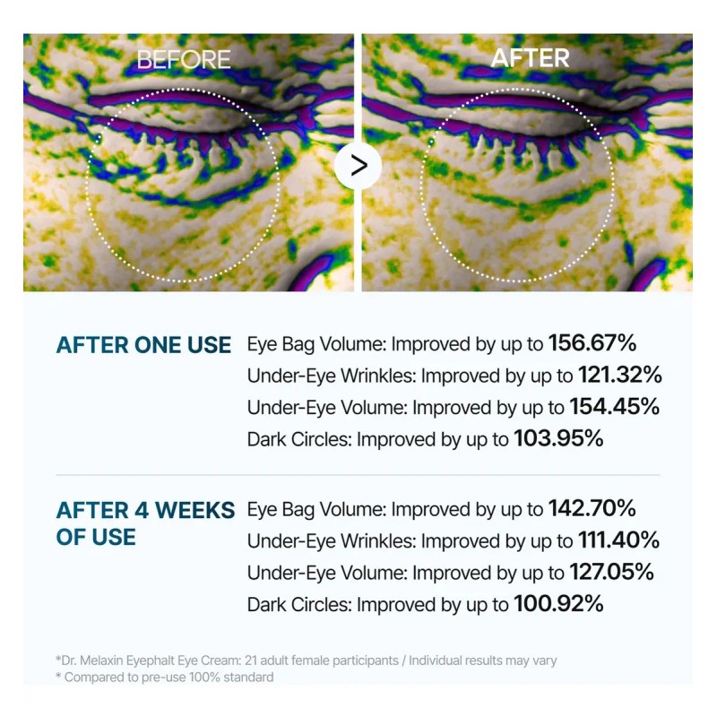 Contorno De Ojos Eyephalt Eyecream For Eyebags De Dr.melaxin Todo