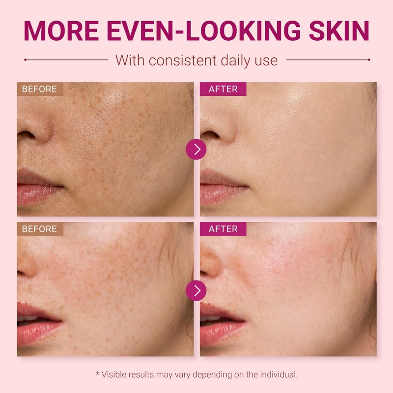 Arbutin & Tranexamic Acid Daily Hydrating Face Cream