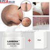 LANBENA Blackhead Remover Cream - 60 Pore Strips for Face and Nose, Acne Peel Off Treatment