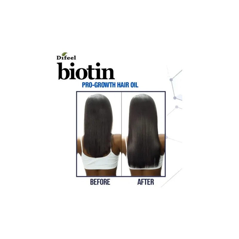 Difeel, Estimulador Para Crecimiento De Cabello 75ml