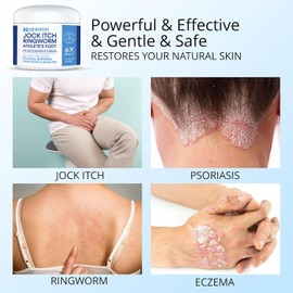 Hermon Itch Relief Cream for Foot & Body Balm, Provides Soothing Relief-100g