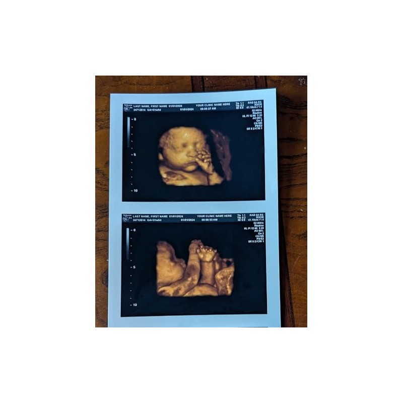 Prank 3D COLOR Customized Fake Ultrasound Strip of 2 Photos