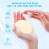 Sulfur Soap for Face with 10% Sulfur, 2% Salicylic Acid,
